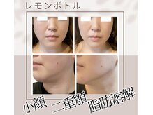 スティーン(Styin)