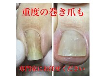 プラスキュア 用賀店(+CURE)の雰囲気(【フットケア】巻き爪・肥厚爪・魚の目・角質・距骨・テーピング)