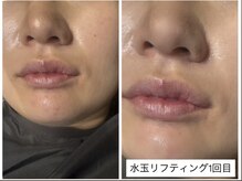 ビジュー(BIJOU)/