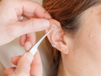 ゆいのわ/耳つぼジュエリー