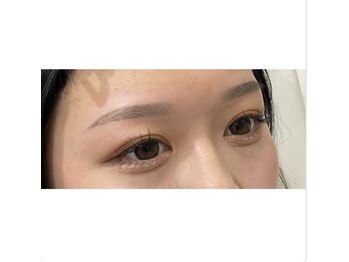 アイズ 天神大名店(eye's)の写真/“お顔のトーン・肌艶アップ”痛みが少ないWAX脱毛で汚れや古い角質をしっかり落としましょう◎