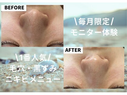 ミルトゥ(myrte)の写真