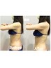 腹部におススメ♪術後インディバBODY+ストレッチ+術後専用クリーム
