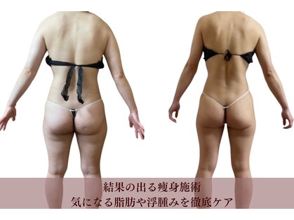 フィカス(FICUS)の写真
