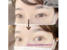 アイラッシュサロン シトロン 祐天寺店(eyelash salon Citron)/【施術後はこんなに違う！】