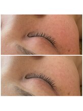 メナードフェイシャルサロン 岐阜茜部/透明感&ツヤ肌