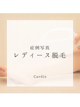 カルディエ(Cardie)/