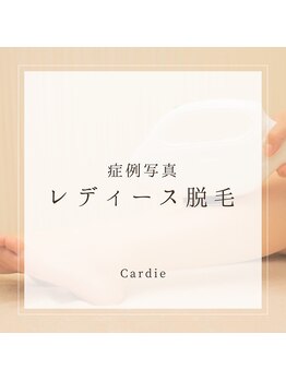 カルディエ(Cardie)/