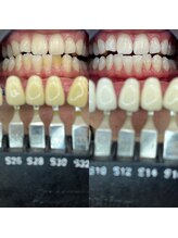 トウキョウスワーズ 池袋店(TOKYO SWRS)/#ホワイトニング #池袋 #渋谷