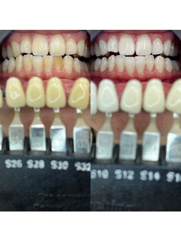 トウキョウスワーズ 池袋店(TOKYO SWRS)/#ホワイトニング #池袋 #渋谷