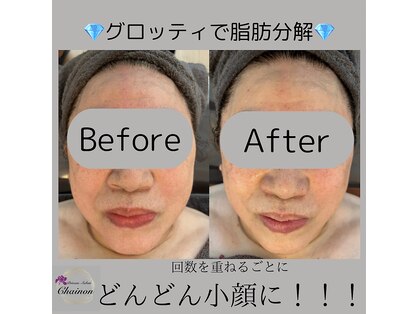 シェノン(Chainon)の写真
