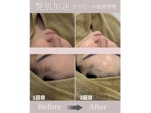 サロンフロム つくば店(Salon From)の雰囲気（【ノーファンデ80%】肌管理も大人気）