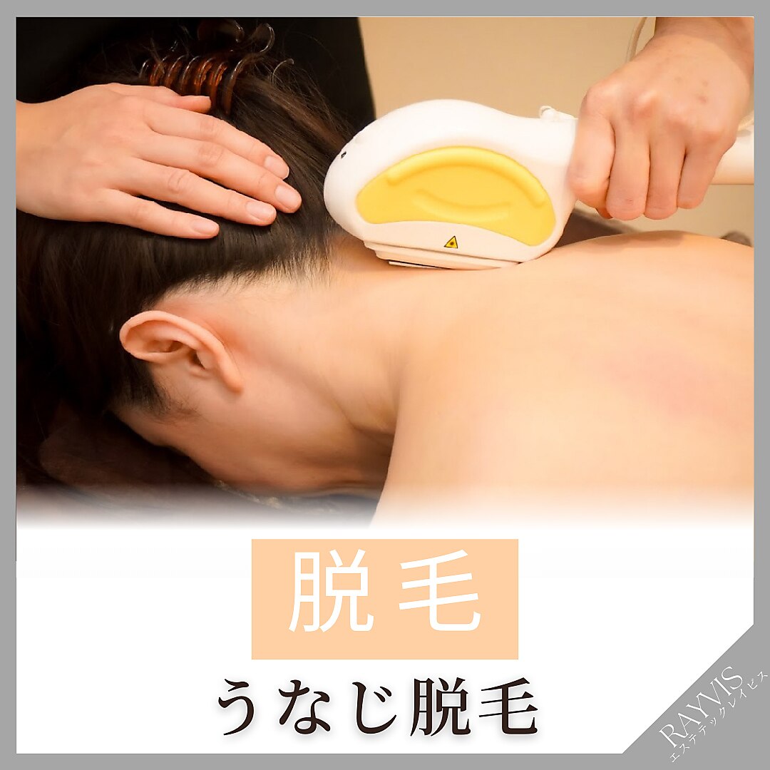 【5/1〜5/10限定】うなじ、背中上IPL脱毛で抜け落ち抜群&後ろ姿美人\3000