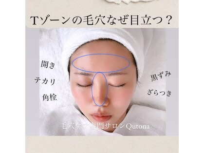 クトナ(Qutona)の写真