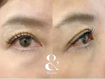 ムニ(muni)/&healthy【アンドヘルシー】