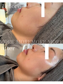 モア 吉祥寺(MORE.)/Before after