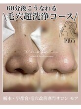 モア(MORE)/