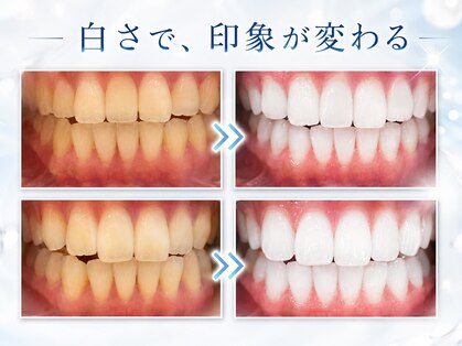 ホワイトニングショップ 仙台店の写真