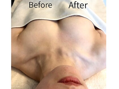 ボニービューティー(Bony Beauty)の写真