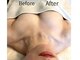 ボニービューティー(Bony Beauty)の写真