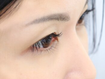 ジーン(jeen)/施術後イメージ