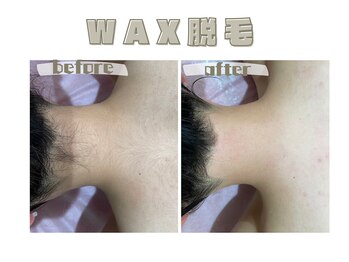 レヴィート(Revept)/【ワックス脱毛】