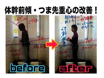 ほねくま整体院 ほねくま接骨院・はりきゅう院 泉中央本院/施術のbefore after