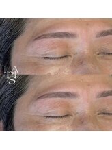 フレイズラピス(FRASE Lapis)/ハリウッドブロウリフト