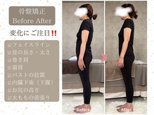 シュガー 津市(Sugar)/産後骨盤矯正♪