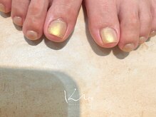 クレー(Klee)/FOOT 美ワンカラー