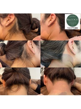 リアココ(Ria.COCO)/うなじダブル脱毛お任せ下さい