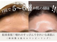 ザ ベルネス(The bellness)