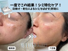 エングラッシー(en glassy)の雰囲気(塗るだけシミケア!ホワイトラボ◎一度でも大きな変化♪)
