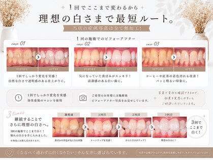 スリール(sourire)の写真