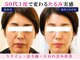 サロンドエステケイワイ(de KY)の写真/劇的結果に自信!【小顔&たるみ改善】背中~肩甲骨から根本改善★プラセンタ+臍帯エキス+ビタミンC導入まで