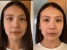 首こりが顔の印象を変えているかも？