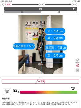 ナオル整体 浅草院(NAORU整体)/AI姿勢診断【側面】