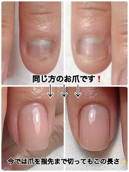 スマイルニコ(smile nico)/爪は変わります！