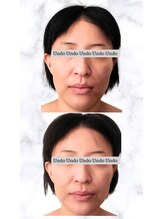 アンドゥ 津田沼(Undo)/一度で分かる透明感と立体感