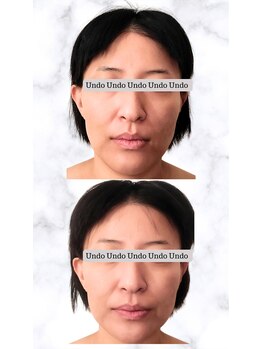 アンドゥ 津田沼(Undo)/一度で分かる透明感と立体感