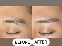 ソーレエルーナ(SOLE e LUNA)/眉毛 アイブロウ 眉 まゆげ 脱毛