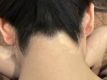 ビューティ ケア ルーム メロウ(Beauty Care Room Moelleux)/左右対象の綺麗なうなじ脱毛♪