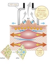 椎名亮 整体院/メディセルの原理です