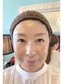 福岡美人工房 アロマムーン ハーブピーリングの最高峰グリーンピール効果の素晴らしさを実感