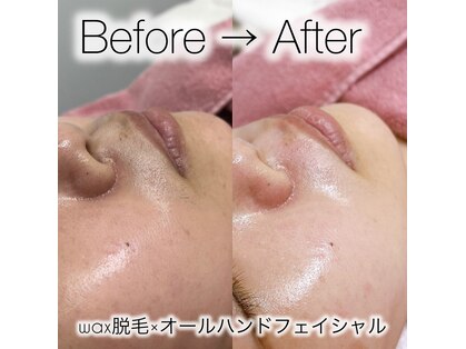 アネーロ(Anhelo)の写真