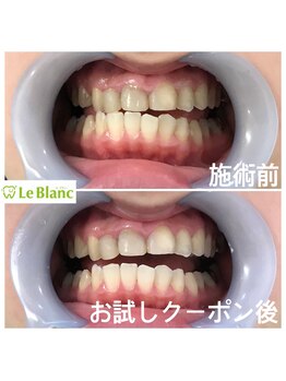 ルブラン 奈良店(Le Blanc)/遠方からお越しくださいました!