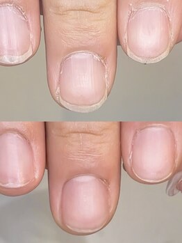 アンクネイル(Ank Nail)の写真/【爪のお悩みに】爪の健康と美しさを引き出す、シンプルだけど大切なケアを丁寧に。ネイルのお休み中にも♪