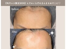 ビオエル(Bioell)の雰囲気（人気No.1★毛穴レス艶玉SKINララWax★毛穴レスの艶肌に♪♪）