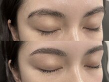 カリスティ(Kallisti)/ハリウッドブロウリフト