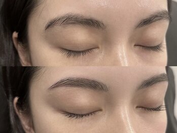 カリスティ(Kallisti)/ハリウッドブロウリフト